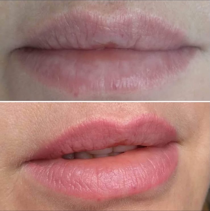 Lèvres — effet voile de couleur sans contour, avant et après